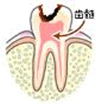 歯髄神経